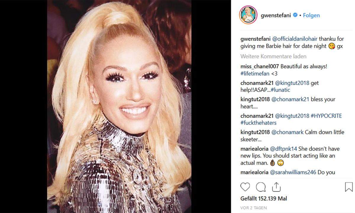Gwen Stefani reiht sich in die Liste der Promi-OP-Gesichter ein. Ihr Instagram-Posts von den „Academy of Country Music Awards“ gefiel nicht allen Fans der Sängerin: Von „unkenntlich“ bis zur Bitte, „es mit den Lippen nicht zu übertreiben“ reichten die Kommentare.