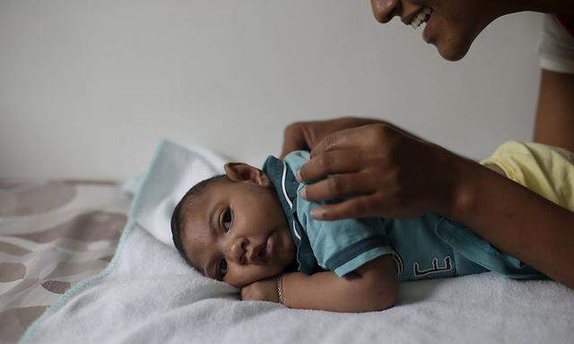 Ein vier Monate altes Baby mit Mikrozephalie in Brasilien.