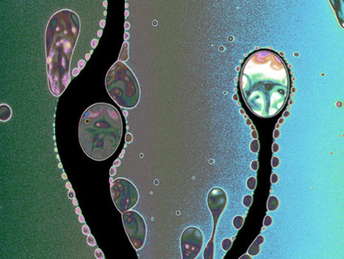 Algen? Tentakel? Fühler? Nein, das hier ist ein Seifenfilm, der sich gerade ausbreitet, aufgenommen mit einem einfachen Mikroskop in zehnfacher Vergrößerung.  Fotograf: Dr. Tsutomu Seimiya, Tokyo Metropolitan University (Japan), 2009