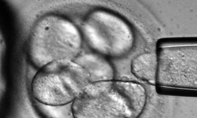 ** ARCHIV ** Auf einem von Advanced Cell Technology zur Verfuegung gestellten Foto wird zur Stammzell