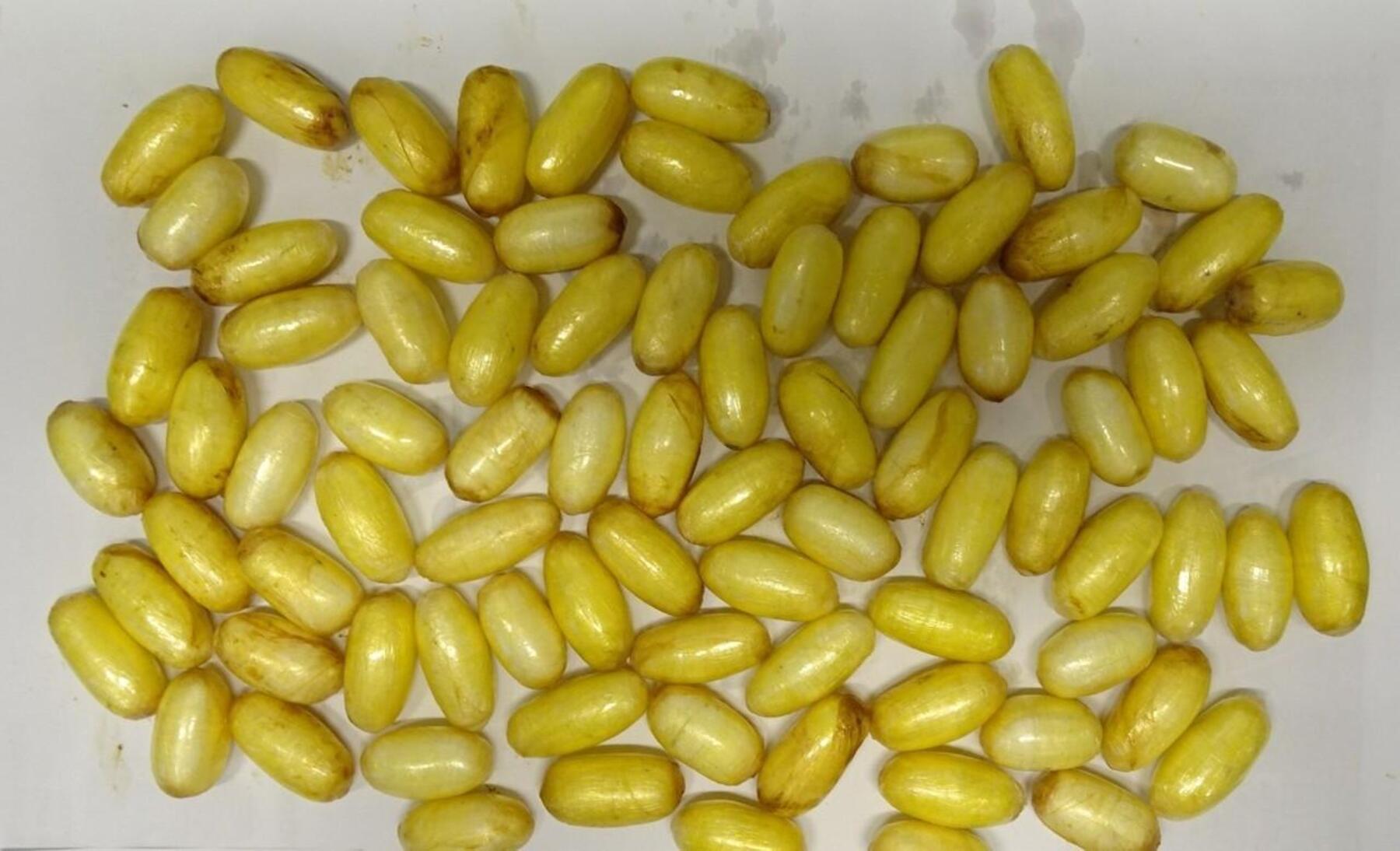 Flughafen Wien: Mann mit 85 Kokain-Päckchen im Bauch gefasst