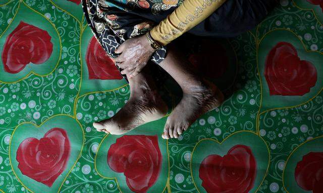 Die Verletzungen verheilen nicht. Begum, die der Rohingya-Volksgruppe angehört, wurde von Soldaten vergewaltigt.