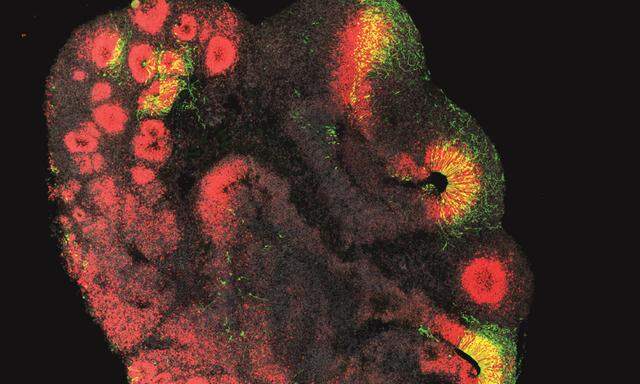 Aus Stammzellen gezüchtet: So sieht ein Hirn-Organoid, wie es die Max-Planck-Forscher züchten, aus.
