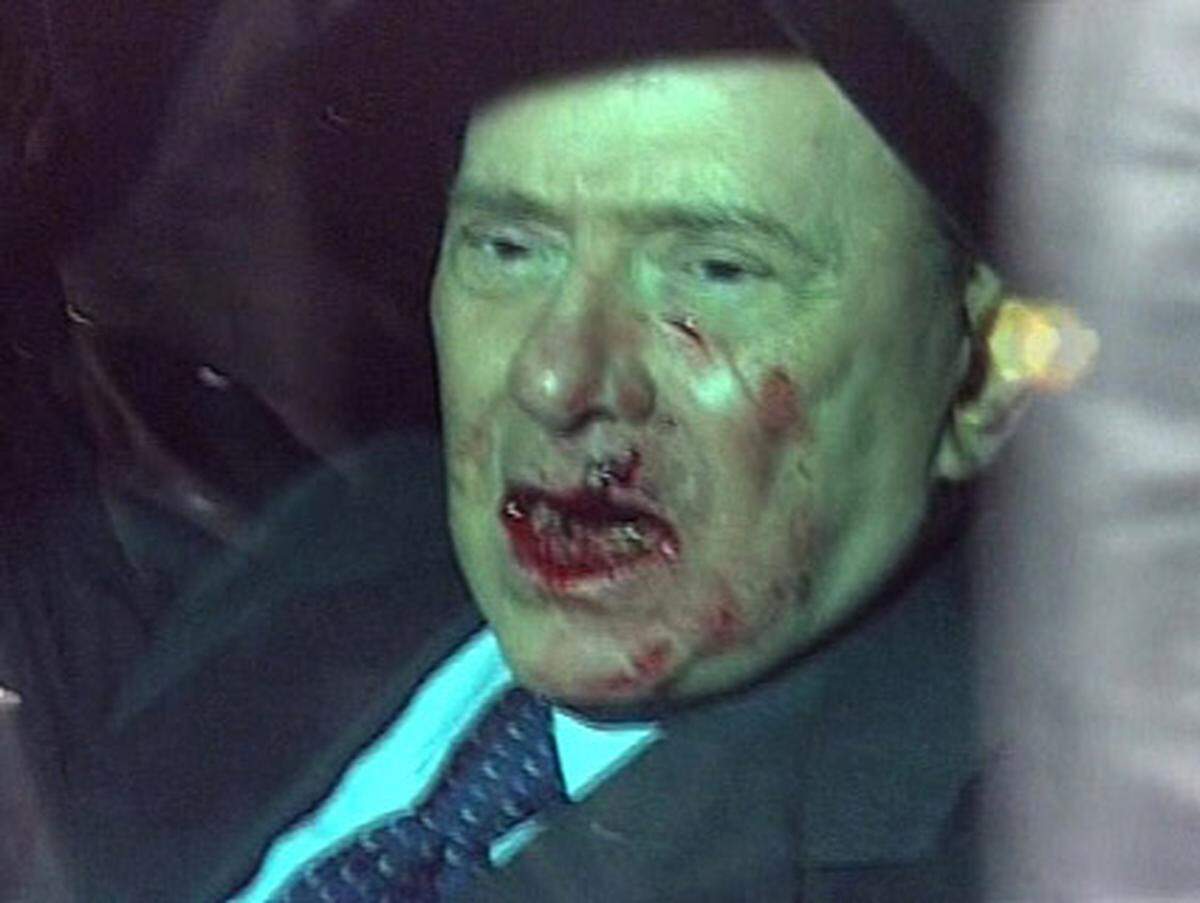 Ein Mann schleudert Berlusconi nach einer Parteirede eine Miniatur des Mailänder Doms ins Gesicht. Nasenbeinbruch und Verletzungen an der Lippe. Außerdem brachen zwei Zähne ab.