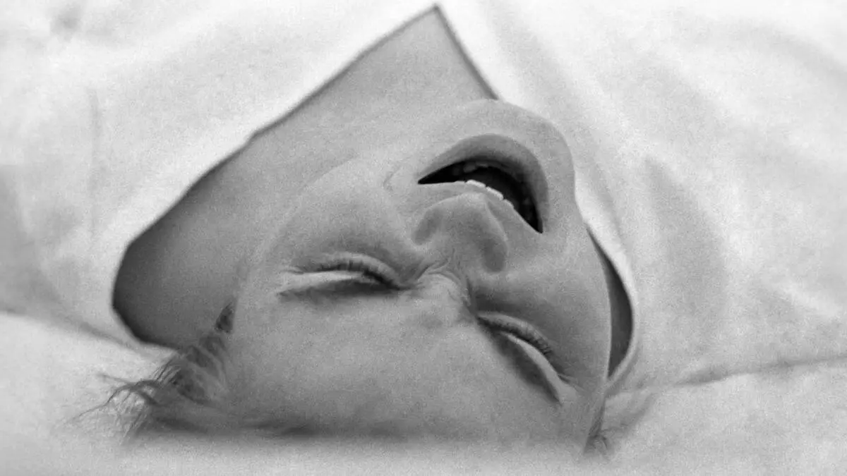 Austrian Supreme Court Grants Maternity Allowance After Termination