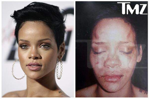 Auf Fotos, die eine Internet-Klatschseite später veröffentlichte, ist Rihanna mit völlig verschwollenem Gesicht und Blutergüssen zu sehen.