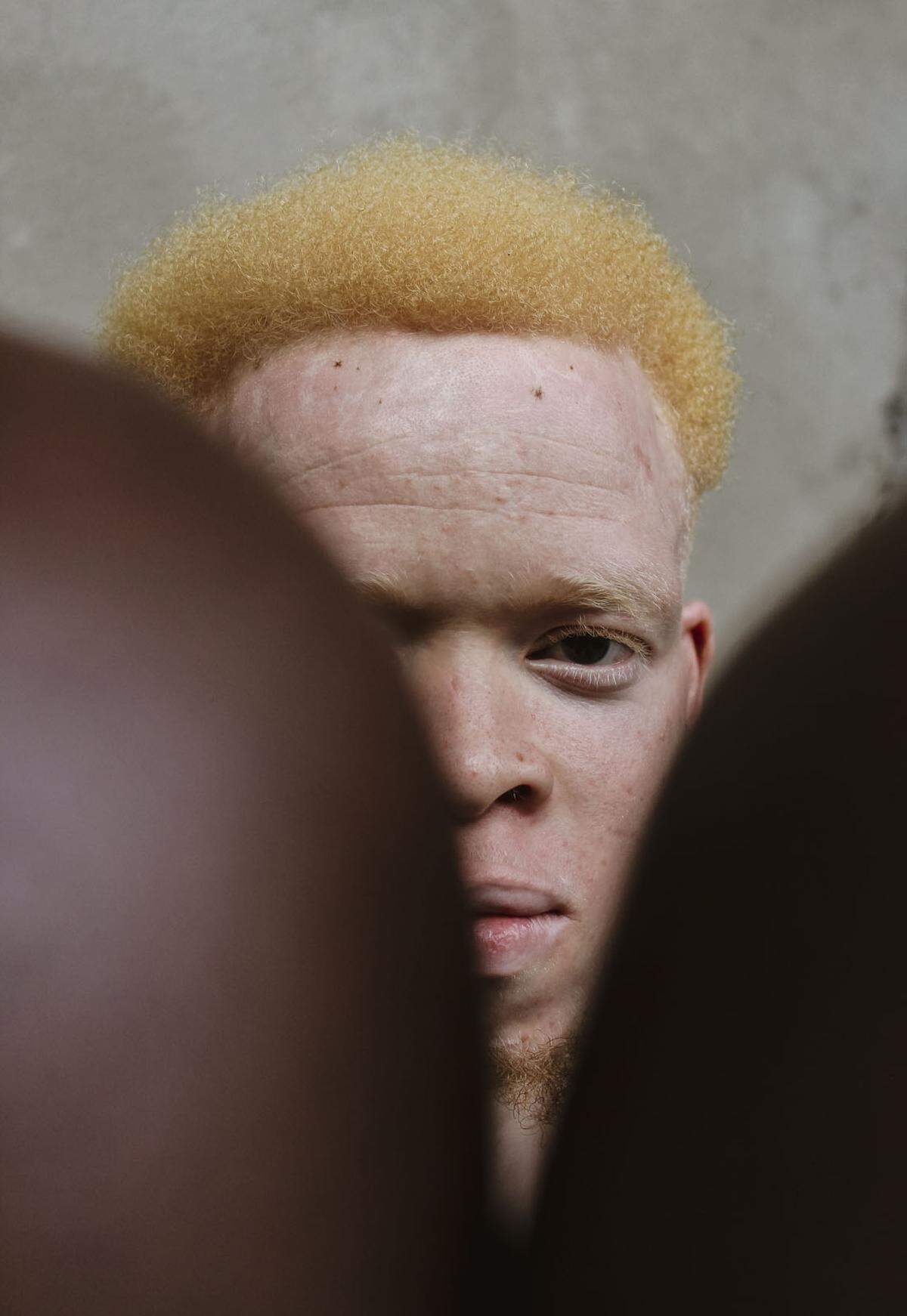 Ein User aus Kamerun reichte dieses Foto ein. Er erklärt: "Es zeigt einen Albino-Mann, der durch seinen direkten Blick zu verstehen gibt: 'Ich kann durch die dunklen Wände sehen, hinter denen ich mich befinde, lasse Blicke und Diskriminierung von mir abprallen. Ich stehe zu meiner Schönheit und akzeptiere mich, wie ich bin.'"    