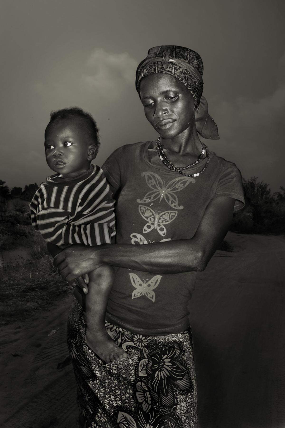 "Ebola-Überlebende" heißt Marcello Bonfantis Fotoserie schlicht. Die Bilder entstanden in Sierra Leone, wo durch die Epidemie 14.122 Menschen erkrankten und 3955 starben. Die 25-jährige Fatmata Kamara und ihr einjähriger Sohn Koday überlebten. Fatmatas Ehemann und ihre Tante starben an der Krankheit.