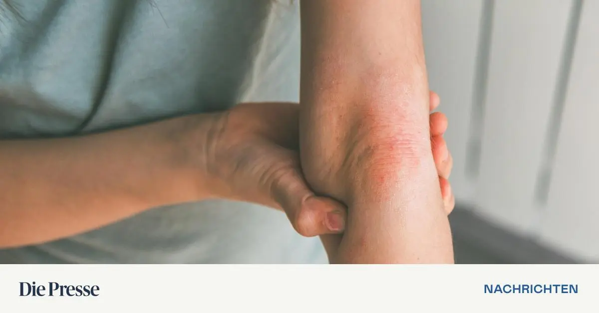 Hautmodelle-aus-dem-3D-Drucker-als-Alternative-zum-Tierversuch