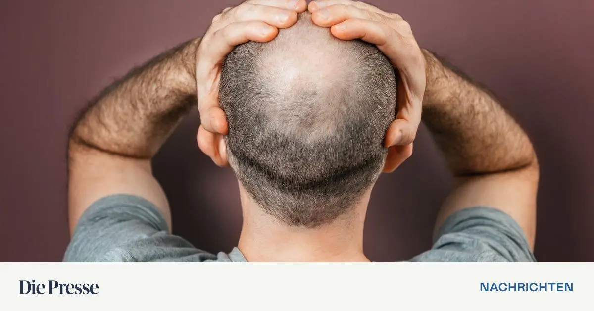 Neues-Mittel-gegen-Haarausfall-vor-Zulassung-Ein-Gamechanger-premium-