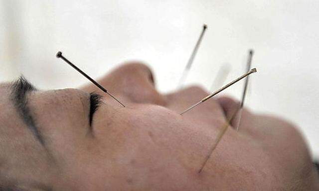 Akupunktur und Karneval werden Weltkulturerbe