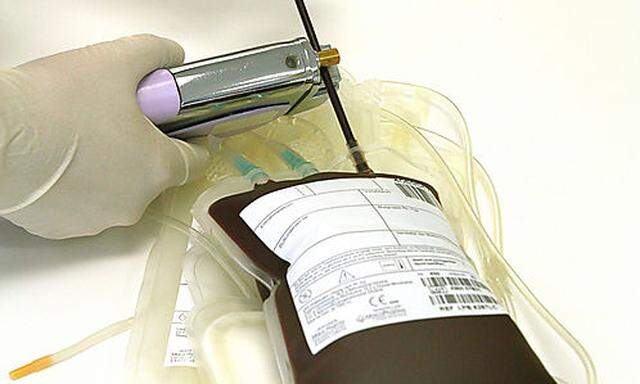 Blutspenden beim Roten Kreuz, verschweissen des Blutbeutels