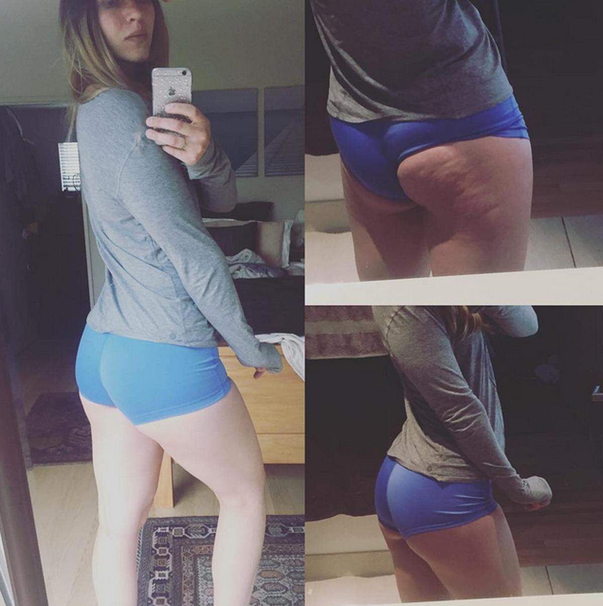 Auch andere Frauen, die sich für ein positives Körpergefühl einsetzen, folgen dem Beispiel der Kanadierin. "Ist es seltsam, dass ich mich den ganzen Tag darauf gefreut habe ein Bild von meiner Cellulite zu posten?", schreibt etwa diese Userin.