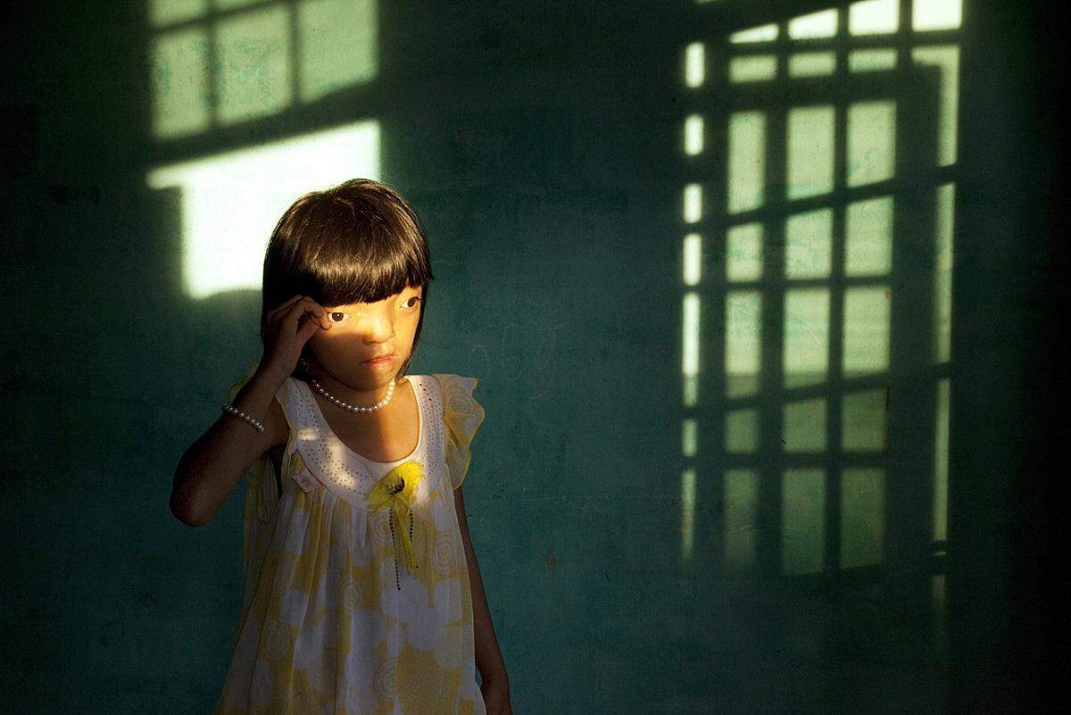 Vietnam, 2010Das Mädchen Nguyen Thi Ly, neun Jahre alt, war noch längst nicht auf der Welt, als der Vietnamkrieg zu Ende ging. Und doch ist sie vermutlich sein Opfer. Agent Orange – das Gift hat zu genetischen Belastungen der Großeltern und Eltern geführt und in weiterer Folge zu Missbildungen bei den Nachgeborenen.Foto: Ed Kashi/VII Photo Agency