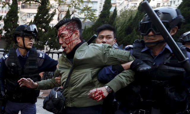 An unidentified injured man is escorted by riot police at Mongkok in Hong Kong