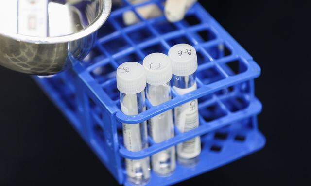 Symbolbild: PCR-Tests
