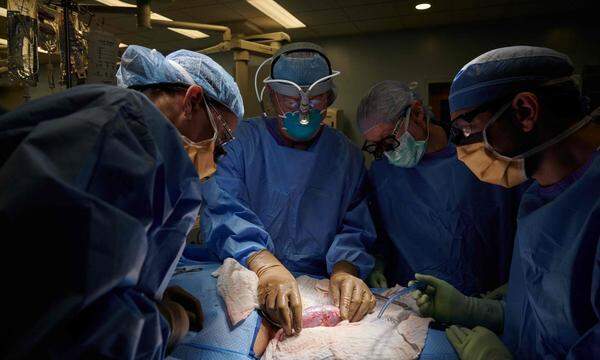 New Yorker Transplantationsteam hat eine Schweineniere für zwei Tage an einen Menschen angeschlossen