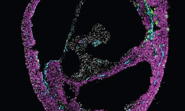 Wenige Millimeter kleine Organoide aus humanen Stammzellen (im Bild: Herzorganoid) könnten der Forschung an neuen Medikamenten gute Dienste leisten. 