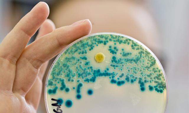 Eine Labormitarbeiterin am Institut für Klinische Mikrobiologie, Immunologie und Hygiene des Universitätsklinikums in Erlangen, hält eine Indikatorkulturplatte zum Nachweis von resistenten Bakterien in der Hand.