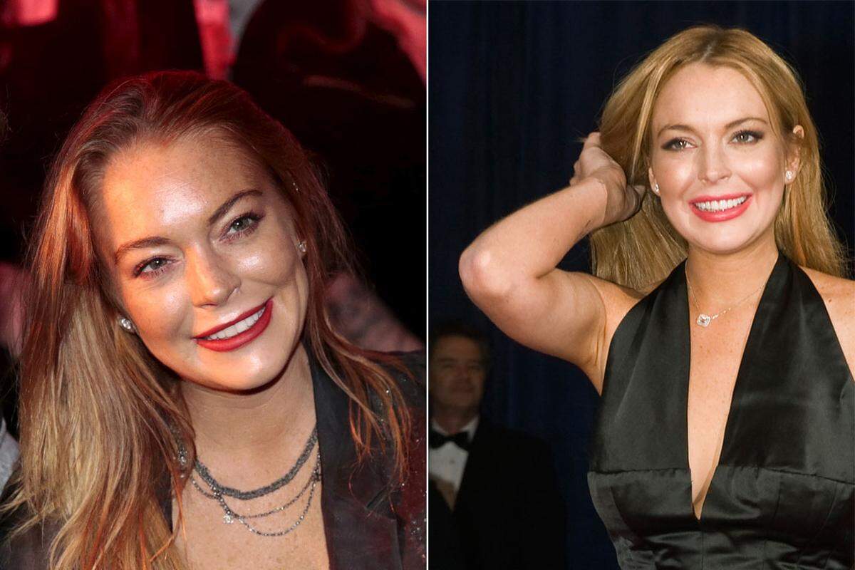 Mit ihren 31 Jahren ist Lindsay Lohan bereits Stammgast beim Beauty-Doc. Das linke Bild wurde bei der Fashion Week in London im September geschossen, das rechte stammt aus dem Jahr 2012. In den Jahren zwischen beiden Aufnahmen liegen mehrere Portionen Botox in der Schlauchboot-Lippe. Nur sehr wenige ihrer jungen Hollywood-Kollegen gehen mit anderen Motiven zum plastischen Chirurgen.