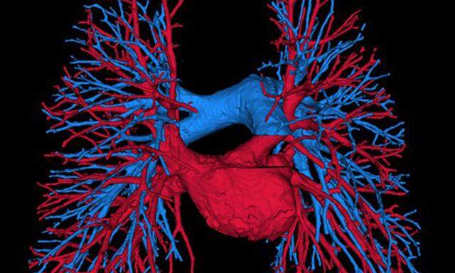 Arterielle (rot) und venöse (blau) Gefäßbäume der Lunge.