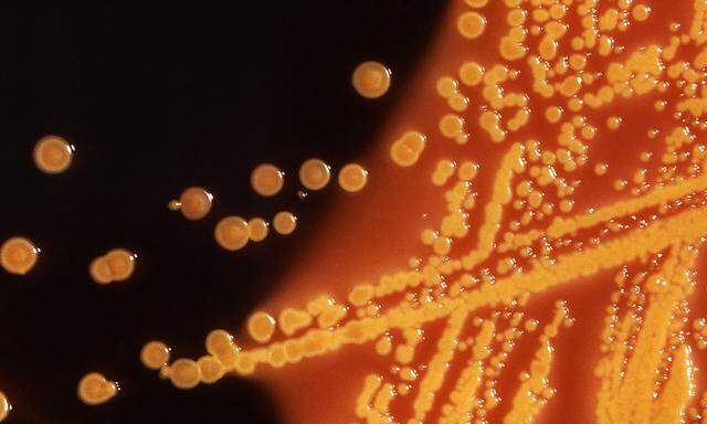 Archivbild. Kolonien von E. coli-Bakterien unter dem Mikroskop. Nicht alle E. coli-Bakterien sind gesundheitsgefährdend, viele davon haben wir auch im Darm.