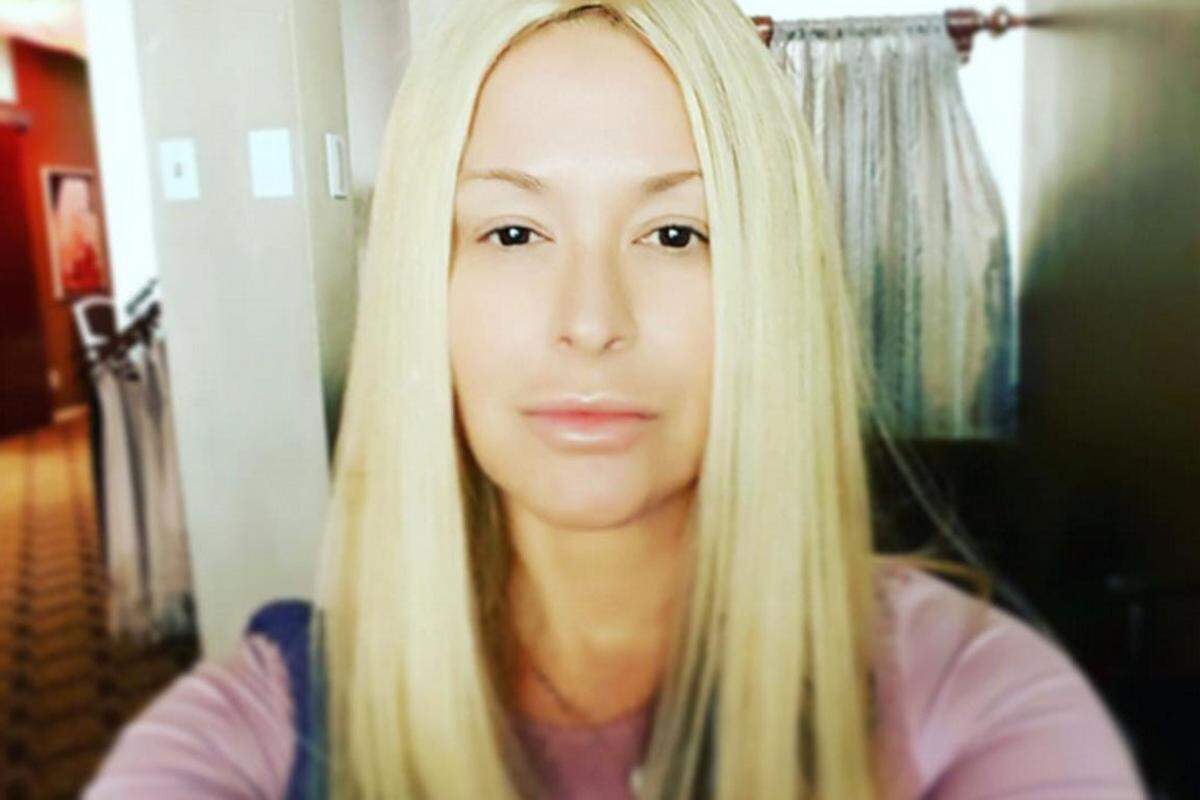 Von Beauty-Eingriffen konnte auch Sängerin Anastacia nicht die Finger lassen.  "Ich war regelrecht süchtig," gestand die 47-jährige, die seit Jahren gegen Brustkrebs kämpft, kürzlich der "Daily Mail" zum Thema Botox. Alle drei Monate habe sie sich ihre Falten aus dem Gesicht spritzen lassen.