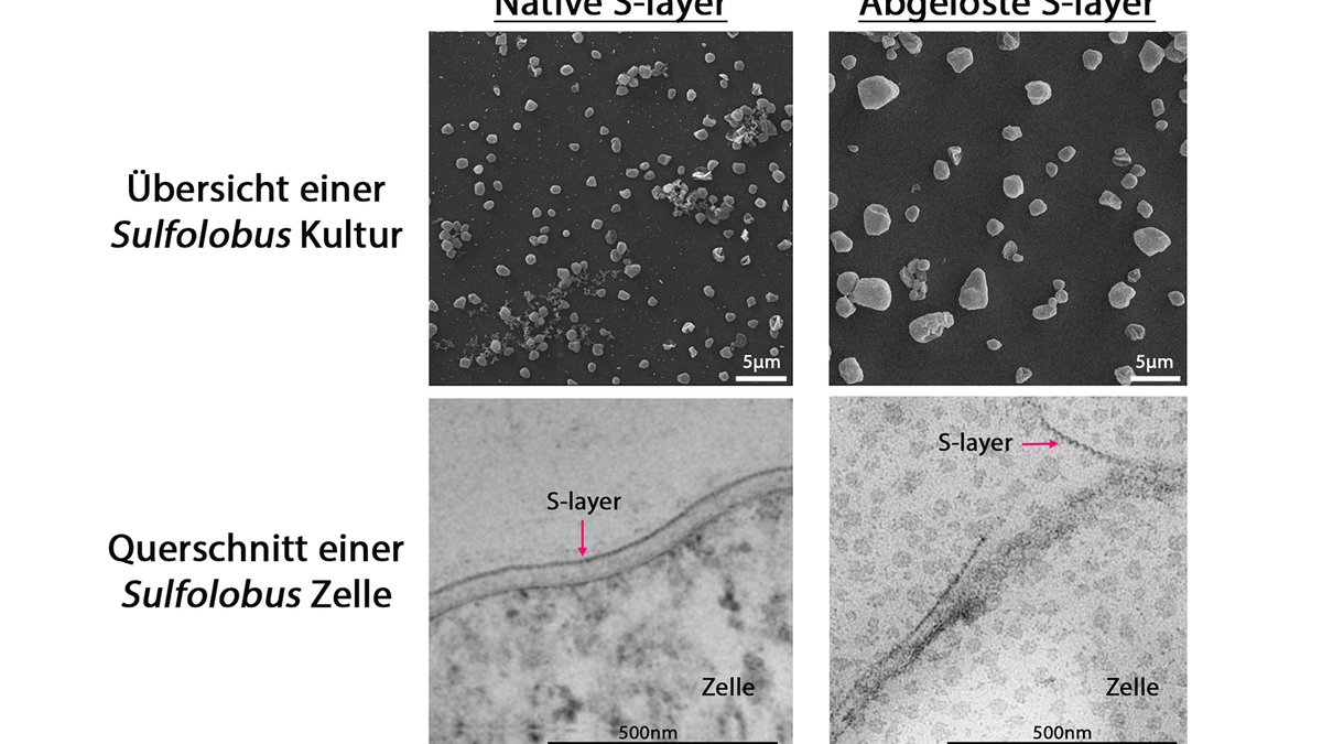 Die vielseitige Rüstung der Mikroben