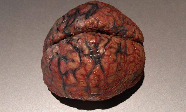 Symbolbild: Das menschliche Hirn.