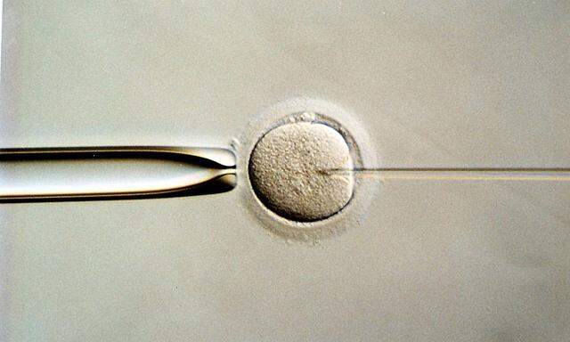 Der Wunsch, ein Kind zu bekommen, lässt sich auf natürlichem Wege nicht immer erfüllen. Im Bild: Künstliche Befruchtung einer Eizelle.
