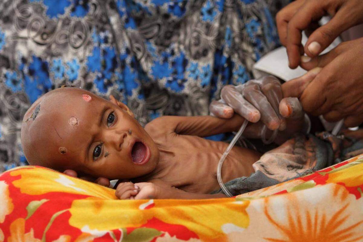 Die katastrophale Hungersnot am Horn von Afrika hält seit Monaten an. Seit Wochen sind elf Millionen Menschen enormer Hitze und quälendem Hunger ausgesetzt. Die schlimmste Dürre seit 60 Jahren hat US-Schätzungen zufolge allein in Somalia bisher 29.000 Kindern das Leben gekostet, 640.000 sind akut unterernährt. Millionen Einwohnern Afrikas droht dieser Tage der Hungertod.