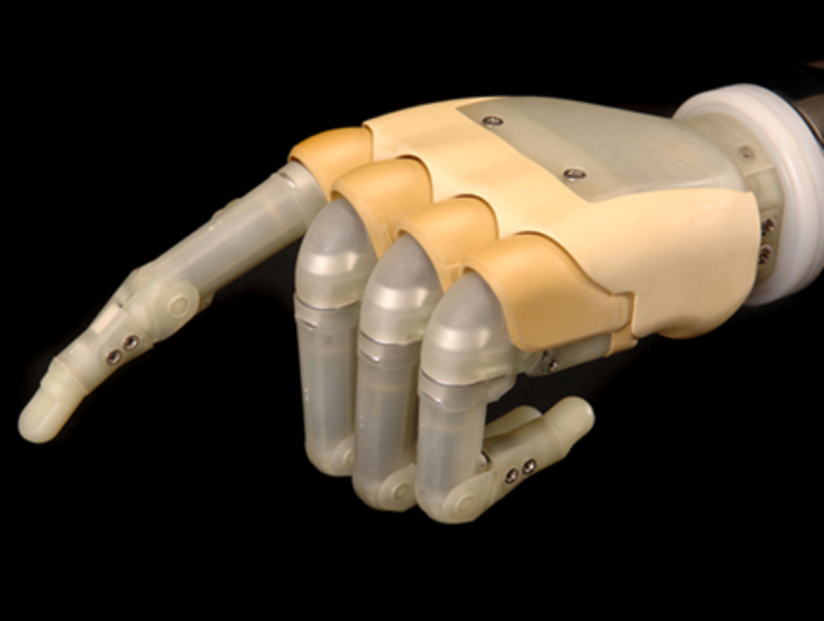 Die Firma "Touch Bionics" hat die erste käuflich erhältliche künstliche Hand entwickelt namens iLimb. Jeder Finger ist durch einen eigenen Motor angesteuert, was sehr präzise Bewegungen ermöglicht.