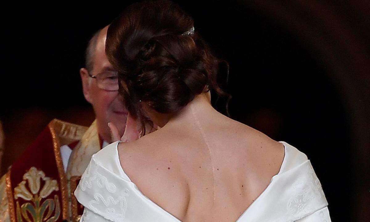 Durch den Rückenausschnitt sind die Narben sichtbar, die eine achtstündige Operation an der Wirbelsäule hinterlassen hat, der sich die Prinzessin im Alter von zwölf Jahren unterziehen musste.