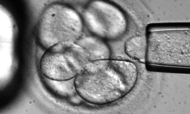 ** ARCHIV ** Auf einem von Advanced Cell Technology zur Verfuegung gestellten Foto wird zur Stammzell