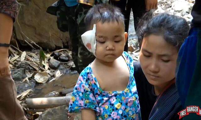 Symbolbild: verletztes Kind in Burma