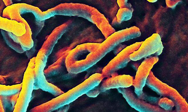 Das Ebola-Virus unter dem Elektronenmikroskop.
