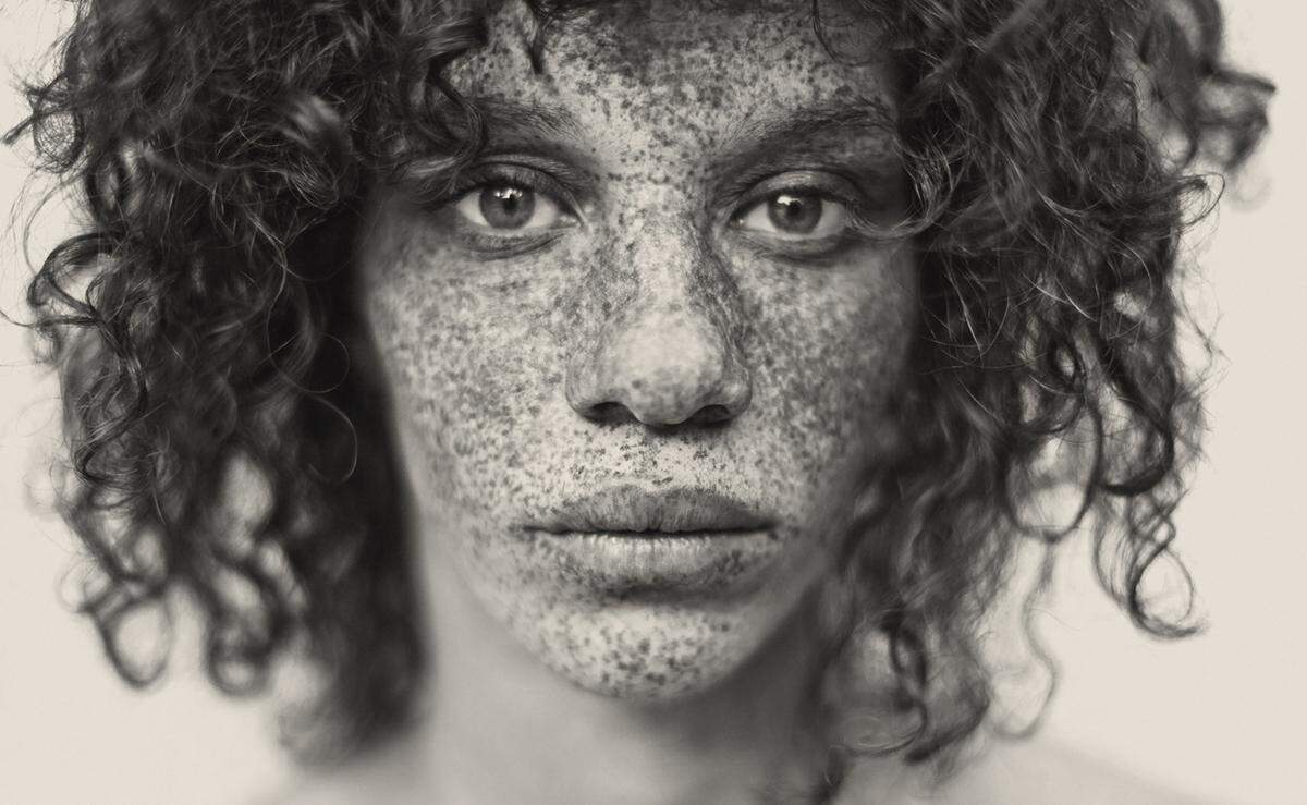 Eine Hommage an die für ihre Besitzer oft so verhassten Sommersprossen ist der Bildband "Freckles" des Schweizer Fotografen und Filmemachers Reto Caduff.