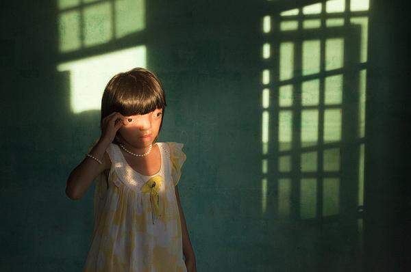 Ed Kashi, USA, VII Photo Agency Die neunjährige Vietnamesin Nguyen Thi Ly leidet an den Spätfolgen von dem Einsatz des Entlaubungsmittels Agent Orange im Vietnam-Krieg