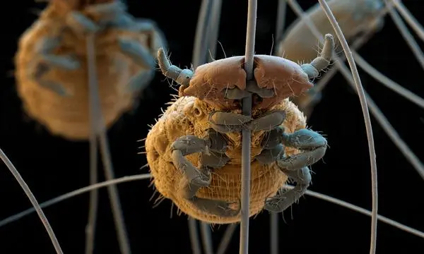 Eine Laus unter dem Rasterelektronenmikroskop.