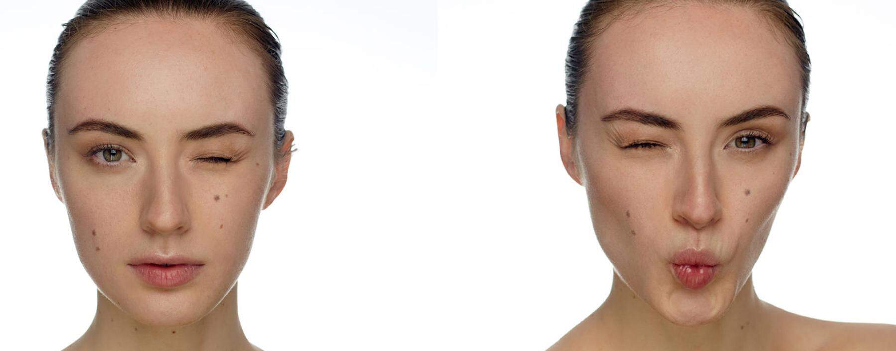 Blinzelworkout. Anastasia Goron trainiert mit bis zu 400.000 Tiktok-Followern ihr Gesicht.
