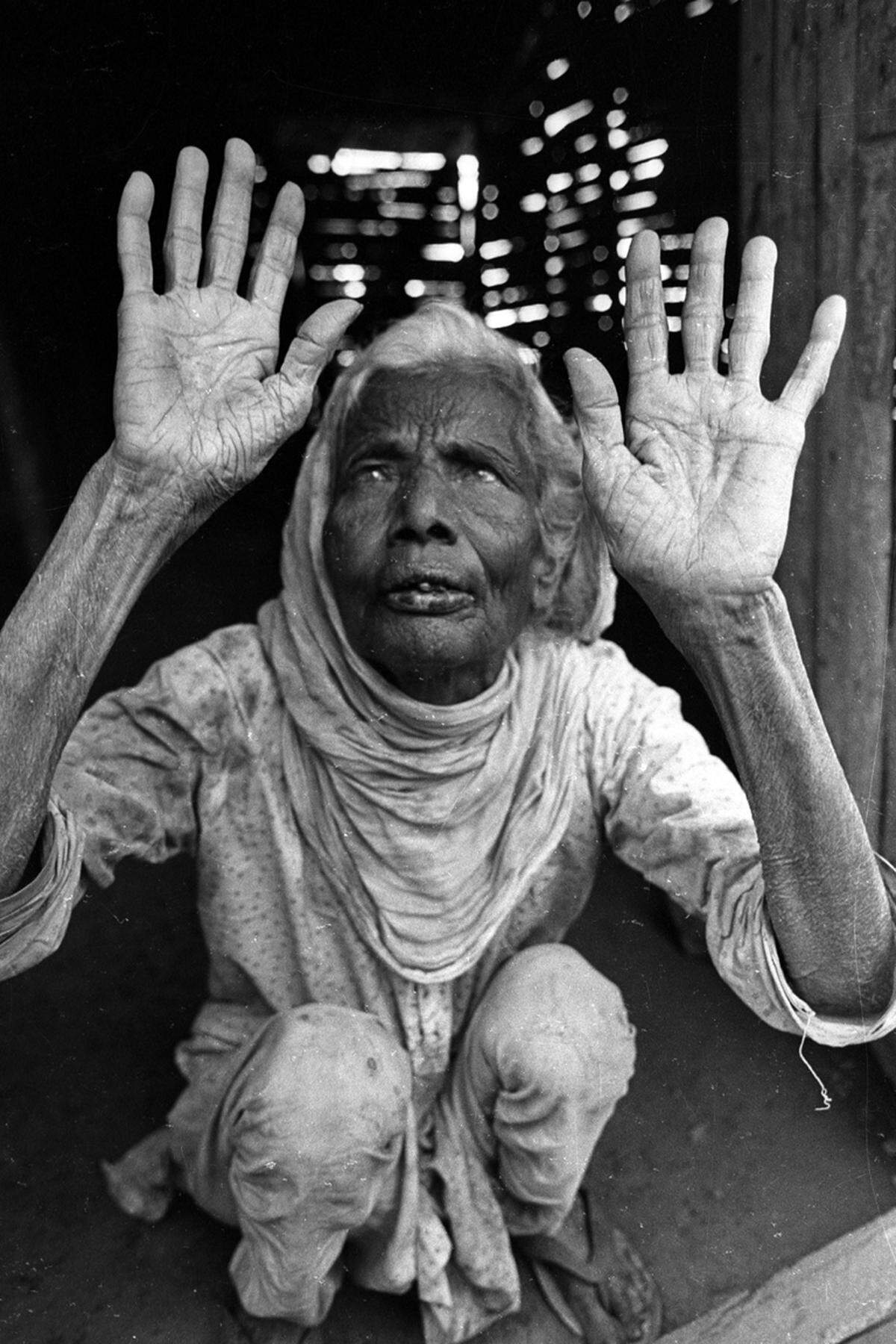 Es war der größte Chemieunfall in der Geschichte, mit mehr Todesopfern als in Tschernobyl, doch der Name "Bhopal" ist auf der Welt wohl nicht halb so bekannt wie jener des stillgelegten Kernkraftwerks. Vor 30 Jahren explodierten in einer Fabrik in der indischen Stadt Tonnen des hochgiftigen Methylisocyanat. Etwa 25.000 Menschen starben, die Überlebenden leiden noch heute an den Folgen.(Bild: Eine bei dem Unglück erblindete Bewohnerin Bhopals)