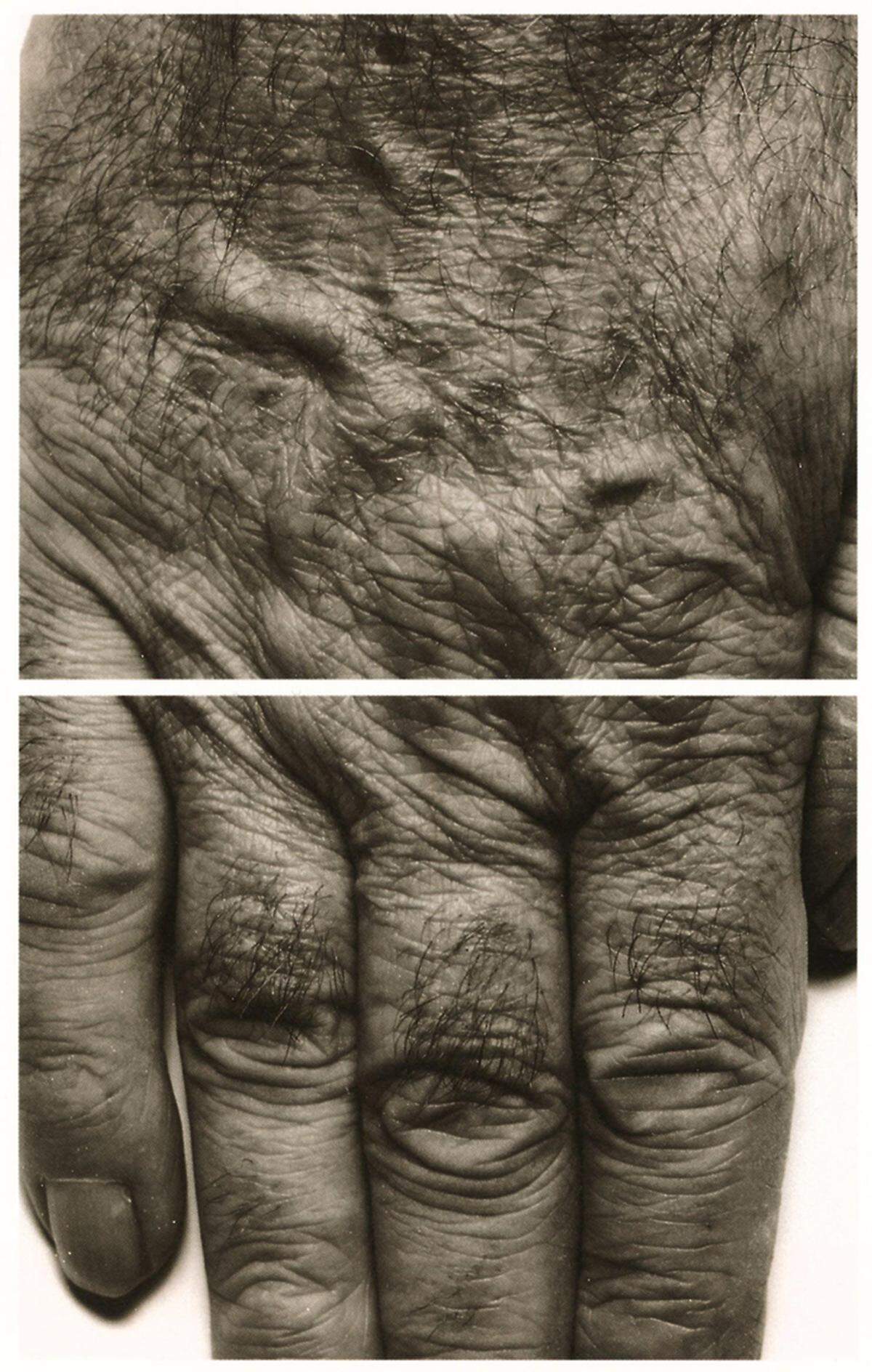 Die großformatigen schwarz-weiß Arbeiten präsentieren "den Körper als Spiegelbild verschiedener Rollen", wie Direktor Klaus Albrecht Schröder mitteilte. John Coplans, Self Portrait (Hands) 1988