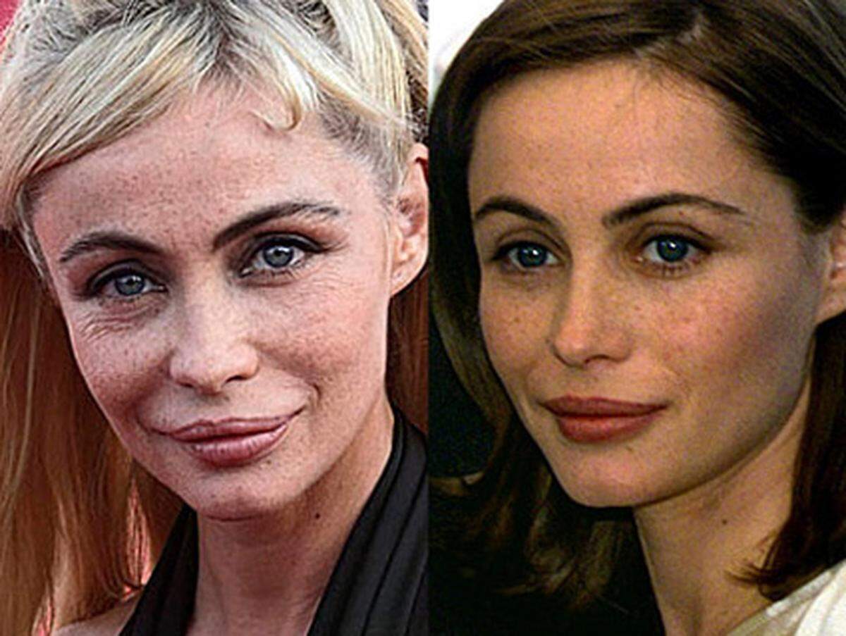 Der Schmollmund war Emmanuelle Béarts Markenzeichen, doch um diesen zu erhalten, hat die 47-Jährige immer wieder nachgeholfen: Rechts ein Bild von 1999, links ein aktuelles.