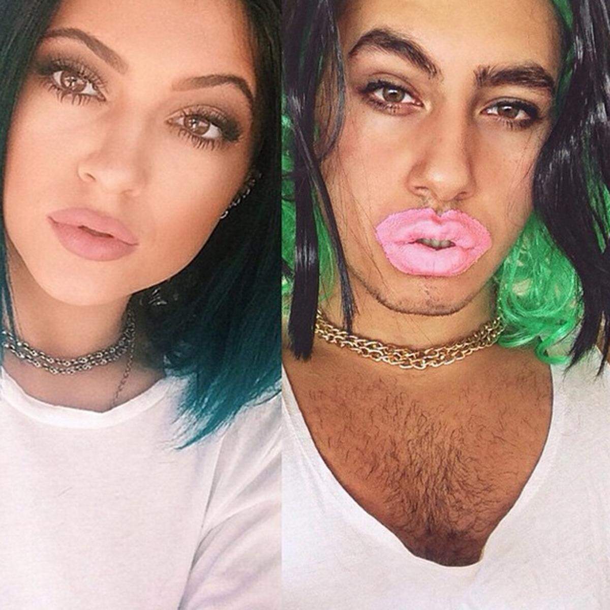 Gerges möchte mit seinen Bildern Stars im neuen Licht zeigen und auch auf den übermäßigen Einsatz von Photoshop aufmerksam machen. Kendall Jenner ließ sich bereits als Teenager die Lippen aufspritzen.