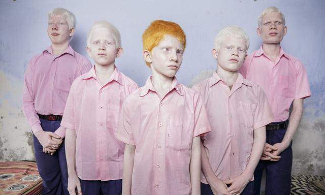 Fünf Schüler in Indien, die mit Albinismus geboren wurden. Das Bild ist Teil einer Sammlung von Arbeiten mit dem Titel „State of Blindness“.