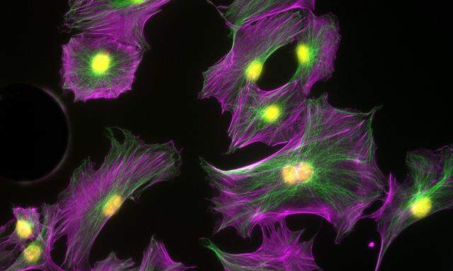 Das sind knochenbildende Zellen, Osteoblasten. Gelb eingefärbt sind ihre Kerne. 