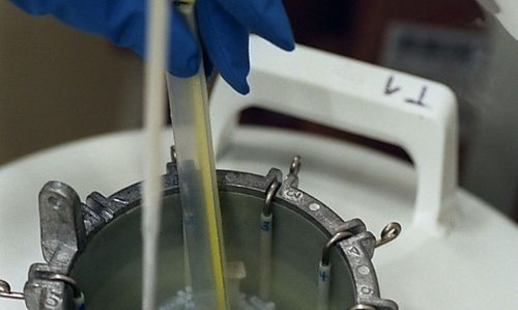 In-Vitro-Befruchtung: Erhhtes Risiko fr Fehlgeburt  DiePresse.com