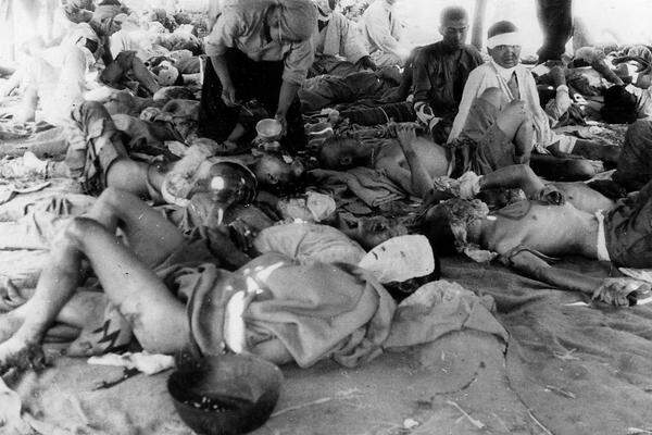 Kurz nach der Explosion glich Hiroshima einem riesigen Lazarett. Tausende Verwundete mussten versorgt werden. Bis Dezember 1945 kamen geschätzt 140.000 Japaner an den akuten Nachwirkungen ums Leben.