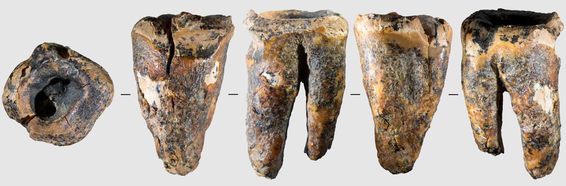 Neandertaler behandelten schon Zähne mit Bohrern