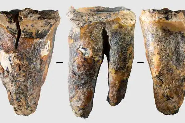 Vor 59.000 Jahren behandelt, nun genau untersucht: Backenzahn eines Neandertalers.